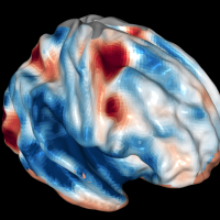 <p>Brain image from a functional MRI scan during tests on the role of the frontal cortex in vision. It's the part of the brain known for being the "thinking cap."</p>