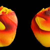<p>Image produced by Richard Gray and Pras Pathmanathan at the FDA shows simulated fibrillation in a rabbit heart. (Credit: FDA)</p>