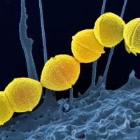 <p><em>Group A Streptococci</em>, colored yellow, are the most common culprits in bacterial upper respiratory infections. Credit: National Institute of Allergy and Infectious Diseases of the NIH</p>
